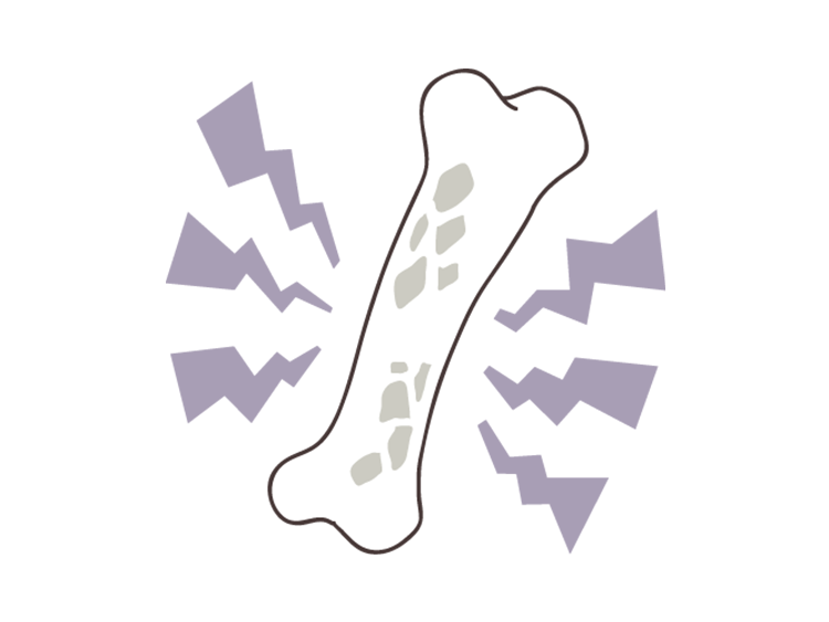 骨粗しょう症